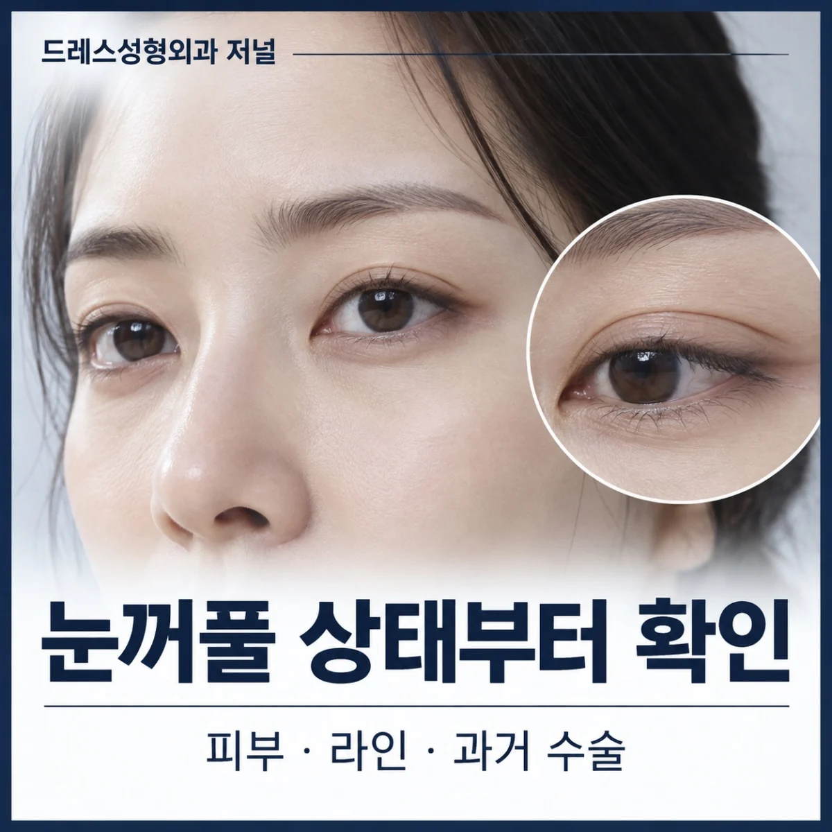 눈꺼풀 피부와 라인을 구분해 살펴보는 실사 사진