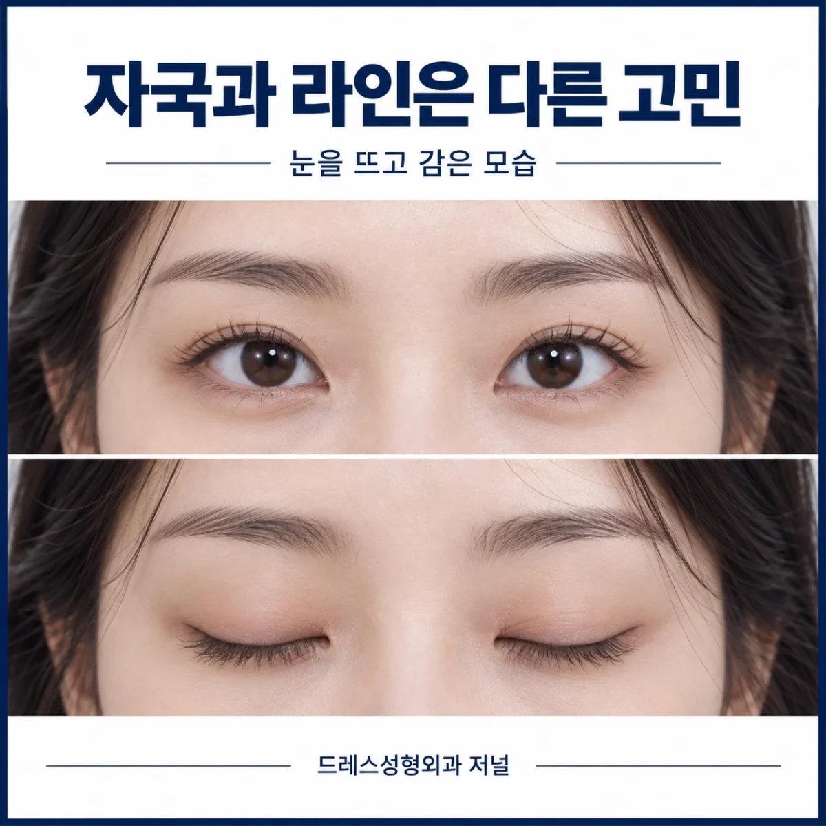 자국과 라인은 다른 고민 — 눈을 뜨고 감은 모습