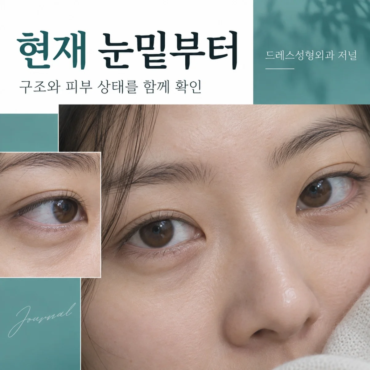 현재 눈밑부터 — 구조와 피부 상태를 함께 확인