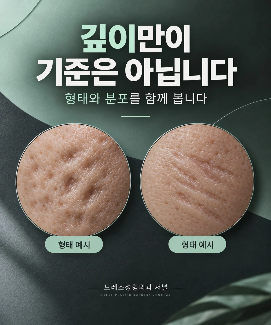 깊이만이 기준은 아닙니다 — 형태와 분포를 함께 봅니다