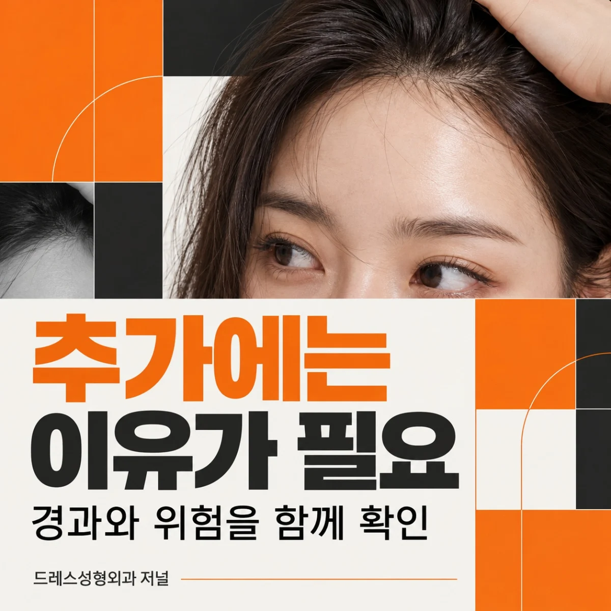 추가에는 이유가 필요 — 경과와 위험을 함께 확인