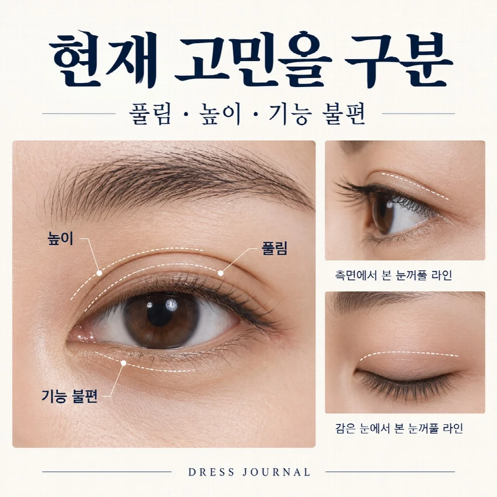현재 고민을 구분 — 풀림 · 높이 · 기능 불편