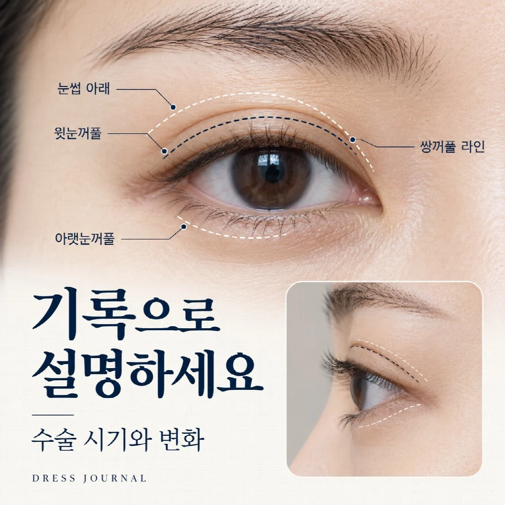 기록으로 설명하세요 — 수술 시기와 변화