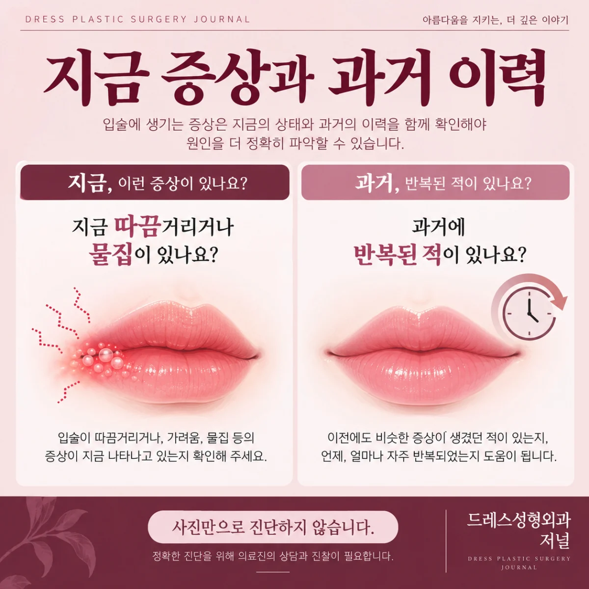 현재 증상과 과거 포진 이력을 나누는 설명 도해