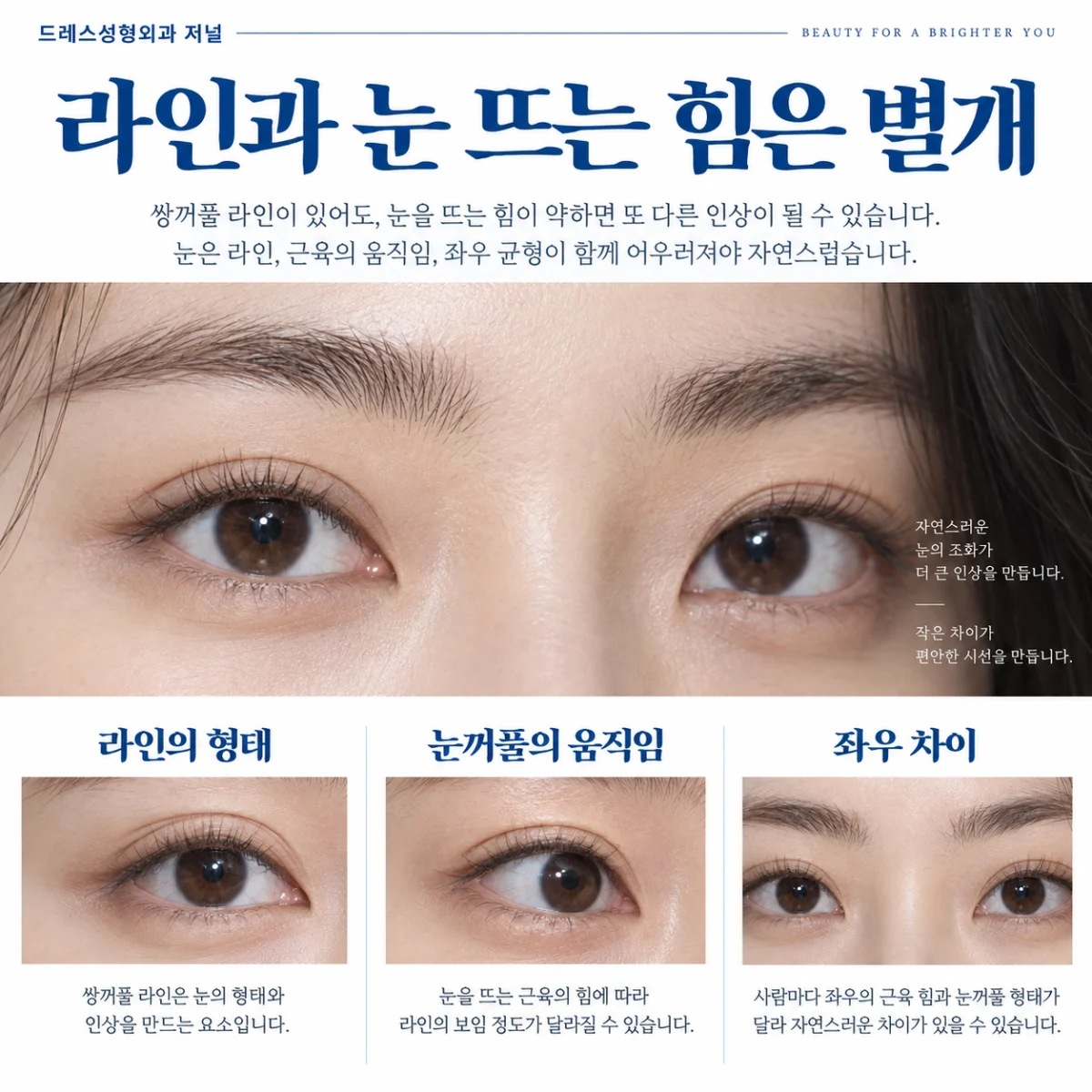 라인과 눈 뜨는 힘은 별개 — 이해를 위한 AI 생성 설명 이미지, 실제 환자 사례나 시술 결과가 아닙니다.