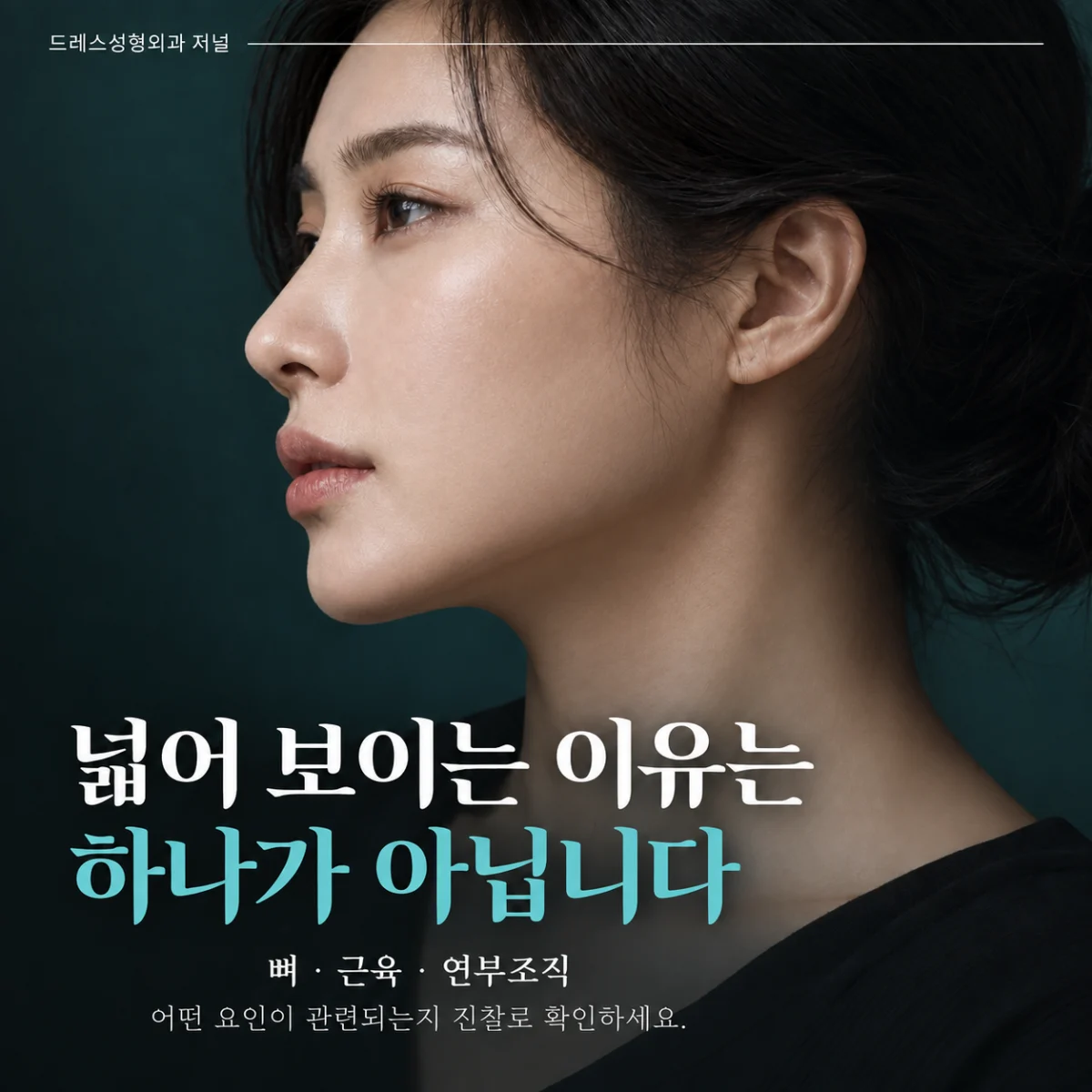 넓어 보이는 이유는 하나가 아닙니다 — 이해를 위한 AI 생성 설명 이미지, 실제 환자 사례나 시술 결과가 아닙니다.