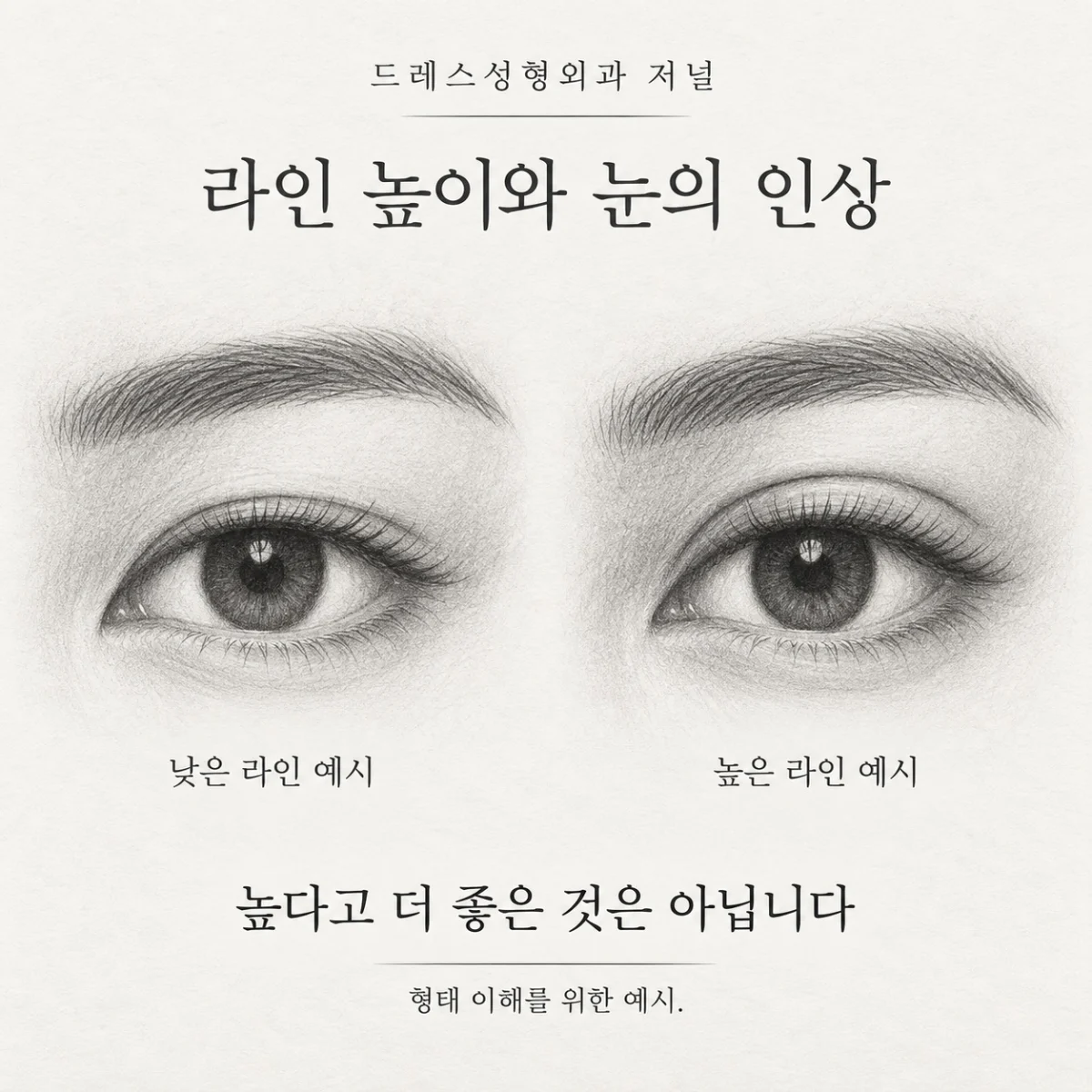 라인 높이와 눈의 인상 — 이해를 위한 AI 생성 스케치, 실제 환자 사례나 시술 결과가 아닙니다.