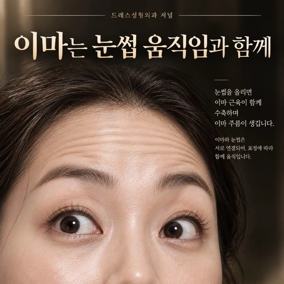 이마는 눈썹 움직임과 함께 — 이해를 위한 AI 생성 설명 이미지, 실제 환자 사례나 시술 결과가 아닙니다.