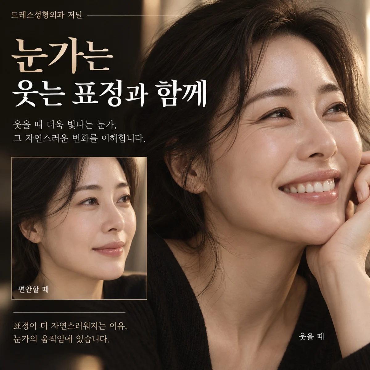눈가는 웃는 표정과 함께 — 이해를 위한 AI 생성 설명 이미지, 실제 환자 사례나 시술 결과가 아닙니다.