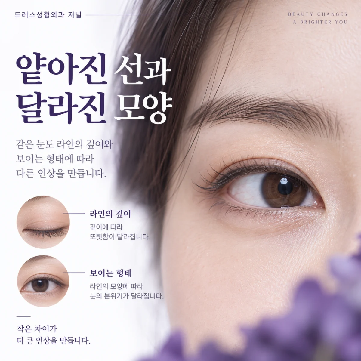 얕아진 선과 달라진 모양 — 이해를 위한 AI 생성 설명 이미지, 실제 환자 사례나 시술 결과가 아닙니다.