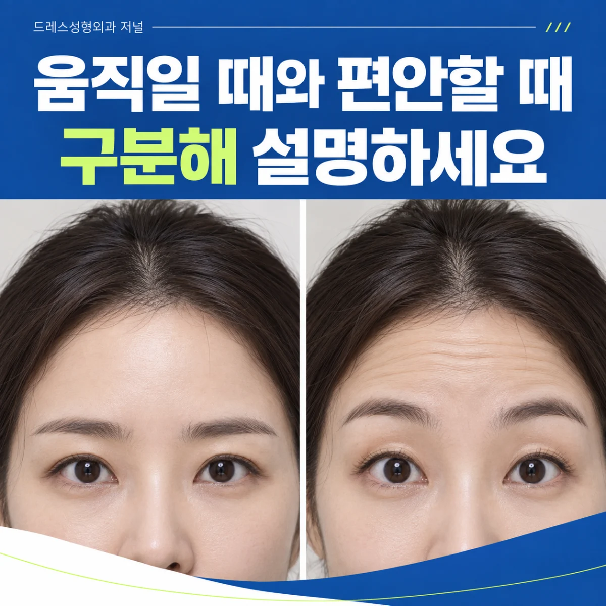 움직일 때와 편안할 때 구분해 설명하세요 — 이해를 돕기 위한 AI 생성 설명 이미지이며 실제 환자나 치료 결과가 아닙니다.