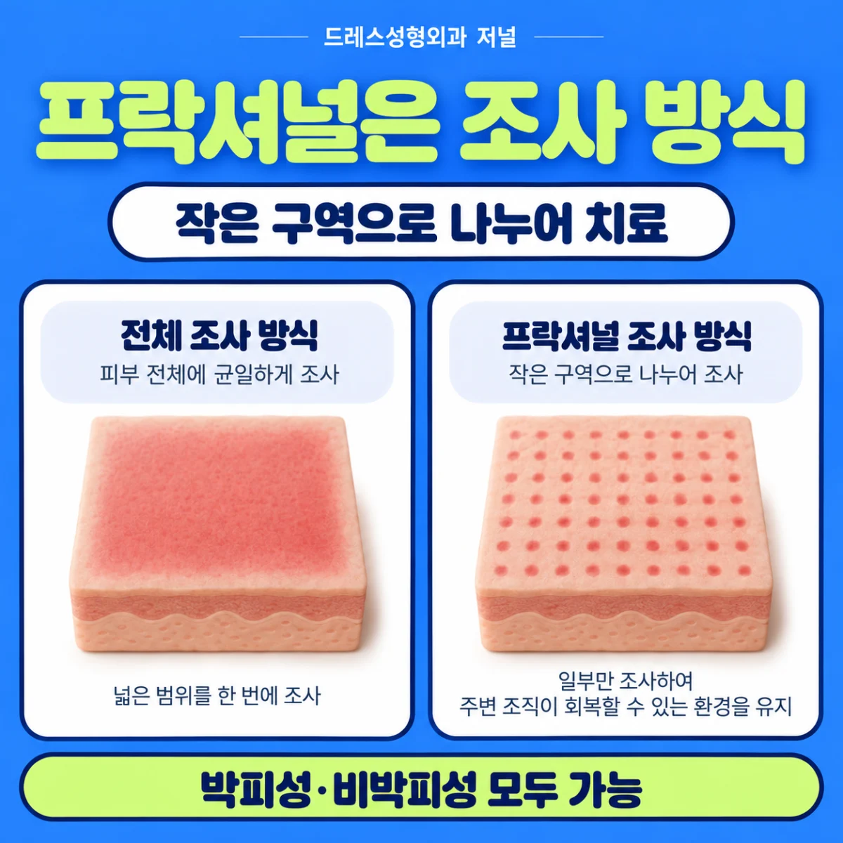 프락셔널은 작은 구역으로 나누어 조사하는 방식