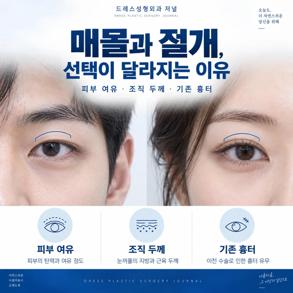피부 여유와 조직 두께, 흉터를 함께 확인하는 눈 주변 사진