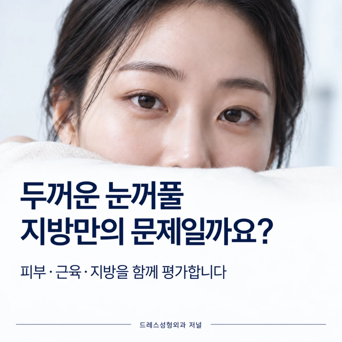 두꺼운 눈꺼풀과 지방의 관계를 소개하는 눈 주변 사진