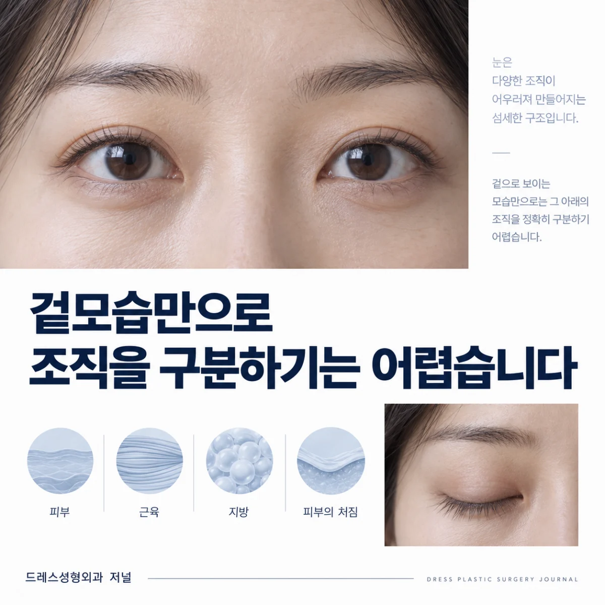 눈꺼풀의 겉모습과 피부·근육·지방 등 평가 요소를 보여주는 카드