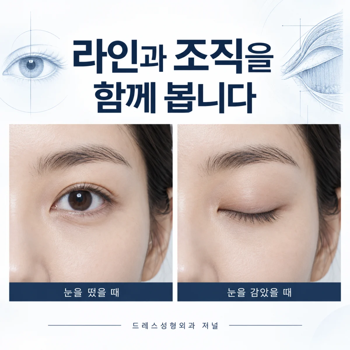같은 눈을 뜨고 감았을 때의 모습을 나란히 보여주는 사진