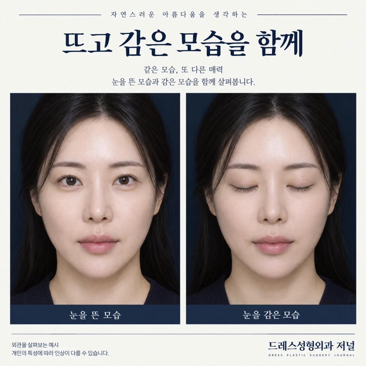 같은 인물의 눈을 뜨고 감은 모습을 비교하는 사진